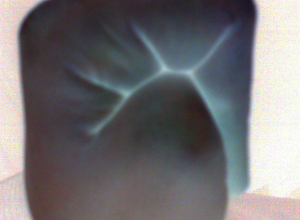 angehngtes Bild