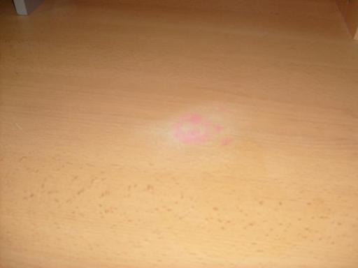 angehngtes Bild