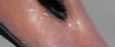 angehngtes Bild