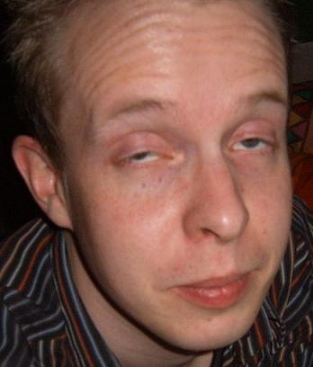 angehngtes Bild